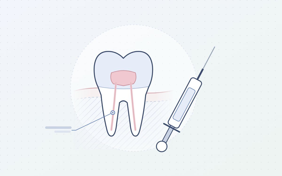 Ilustración: muela junto a una jeringa de anestesia dental