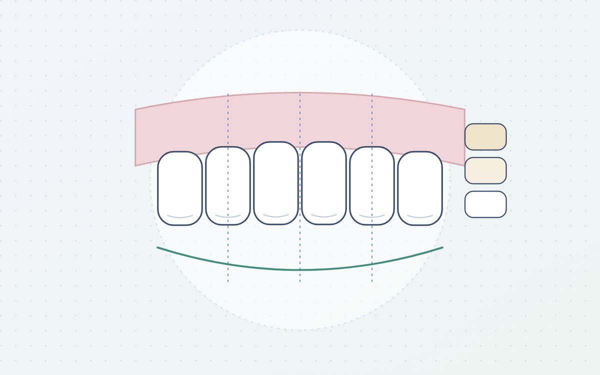 Ilustración: proporciones de la sonrisa y guía de color