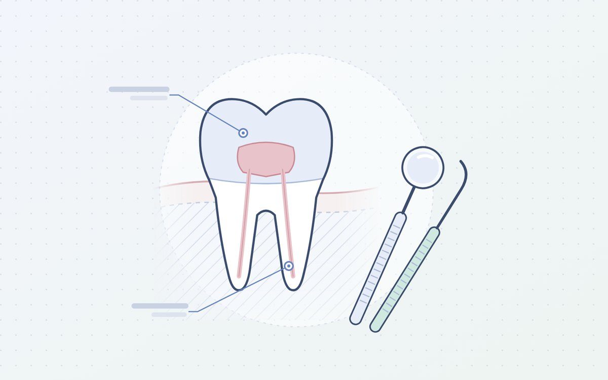 Ilustración: corte de una muela junto a espejo dental y sonda